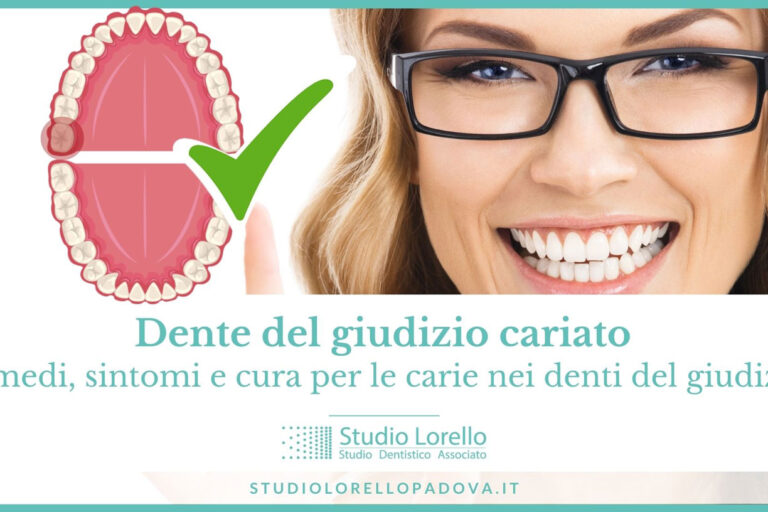 Dente del giudizio cariato