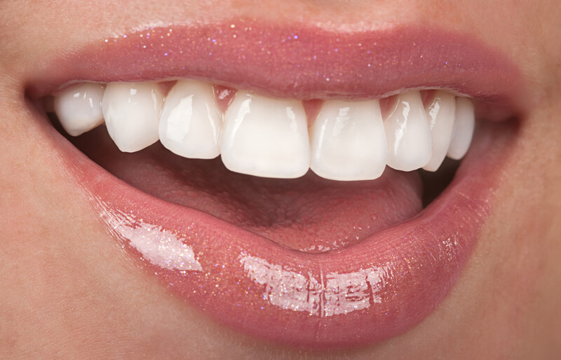 implantologia dentale ritrova il sorriso