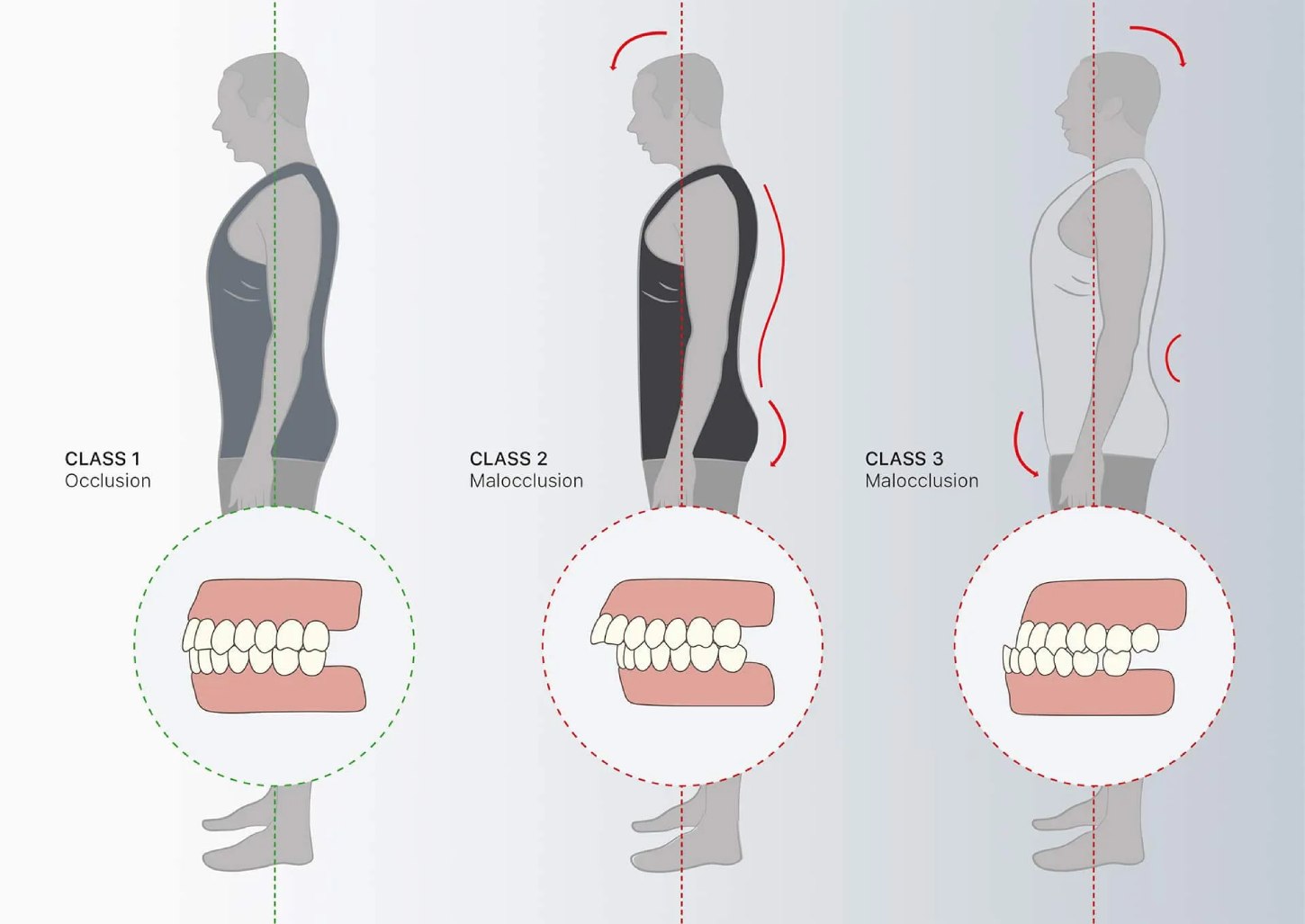 Ortodonzia posturale