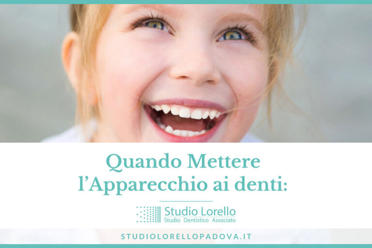 Quando mettere l'apparecchio ai denti